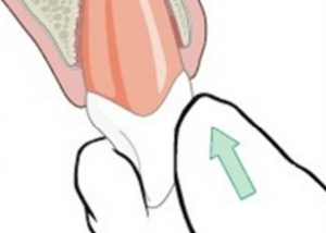 Illustration of fingers putting a tooth back in its socket