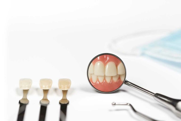 illustration of 3 teeth with varying colors of tooth discoloration next to a mirror showing a white smile
