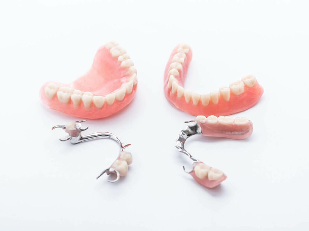 full and partial dentures laying next to each other on white background