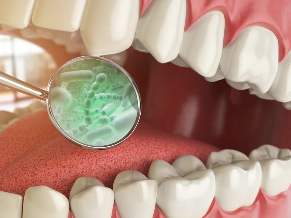 Bad Breath Treatment in Maynard, MA at Maynard Family Dentists